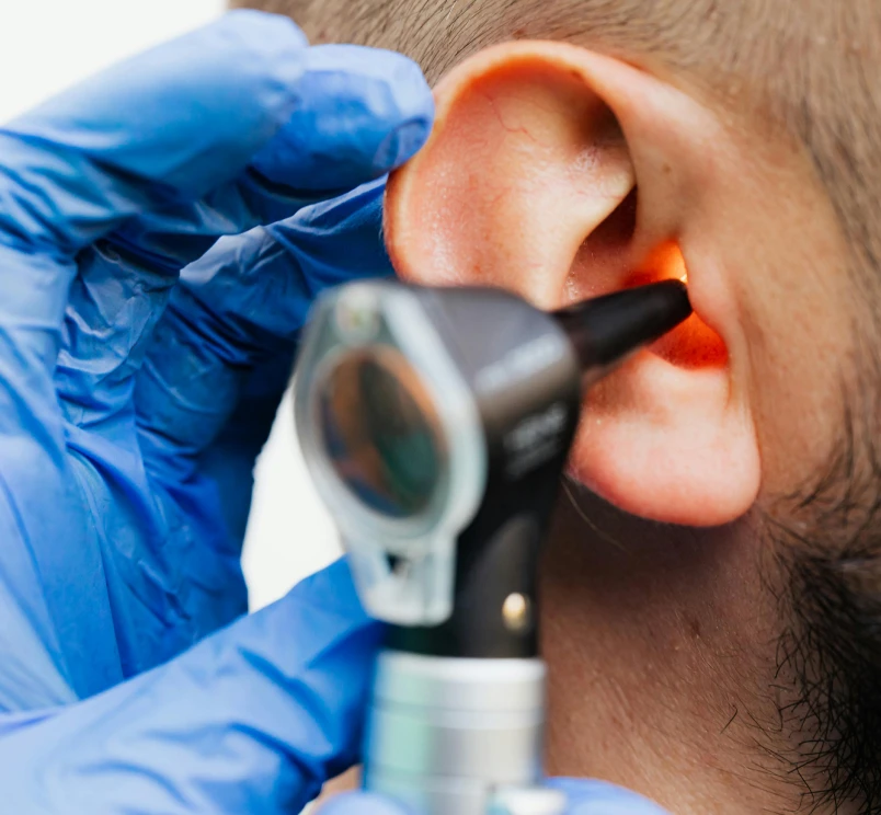 Ear Surgery
