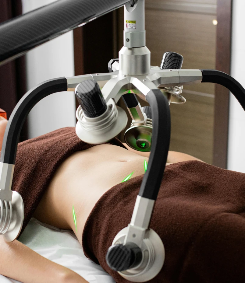 Liposuction