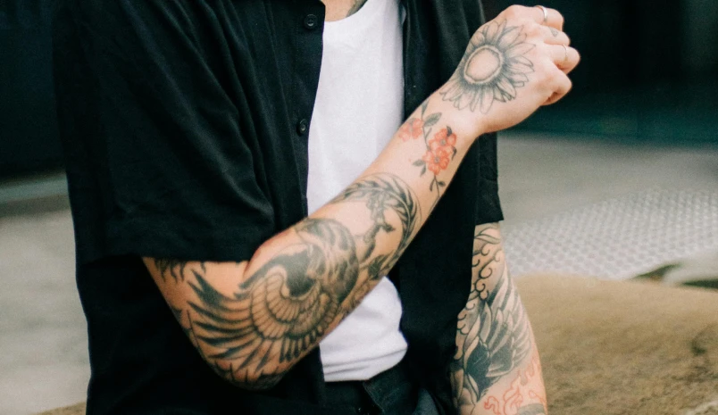 Tattoo Excision