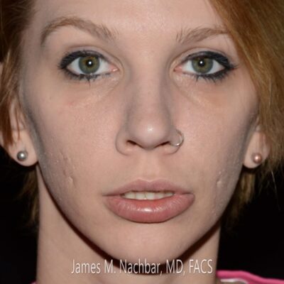 9 Months After