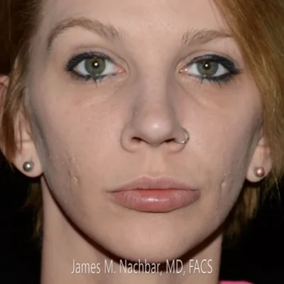 9 Months After