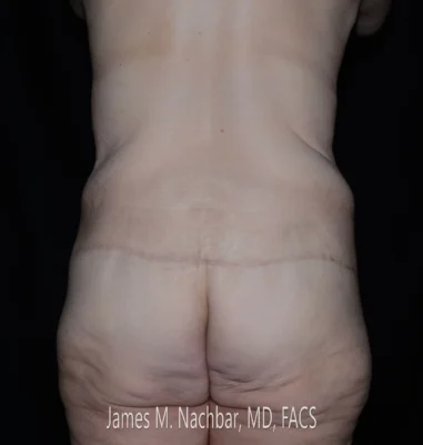8 Months After