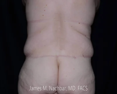 8 Months After