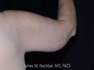 Six Weeks After