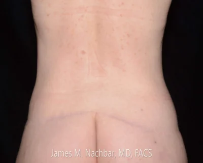 9 Months After