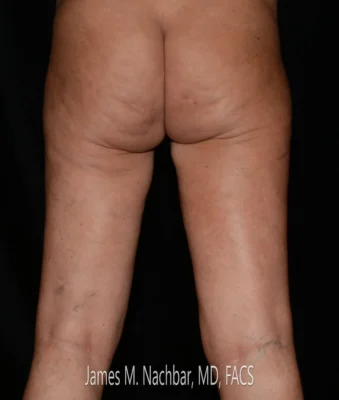 9 Months After