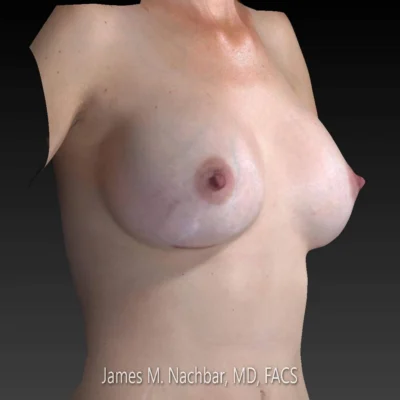 9 Months After, 3D pic