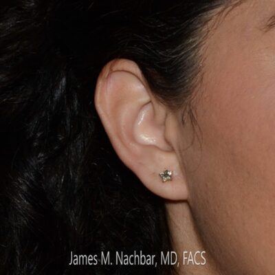 Right Ear with Earring
