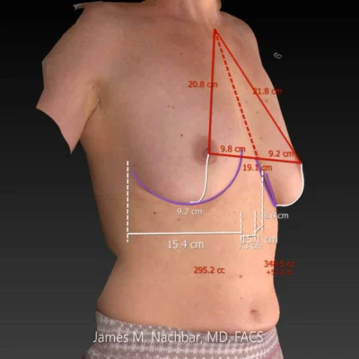 3-D Image