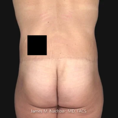 16 Months After