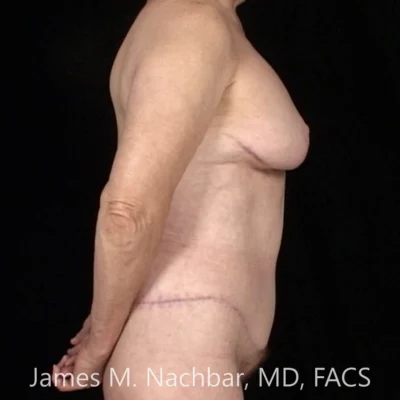 8 Months After