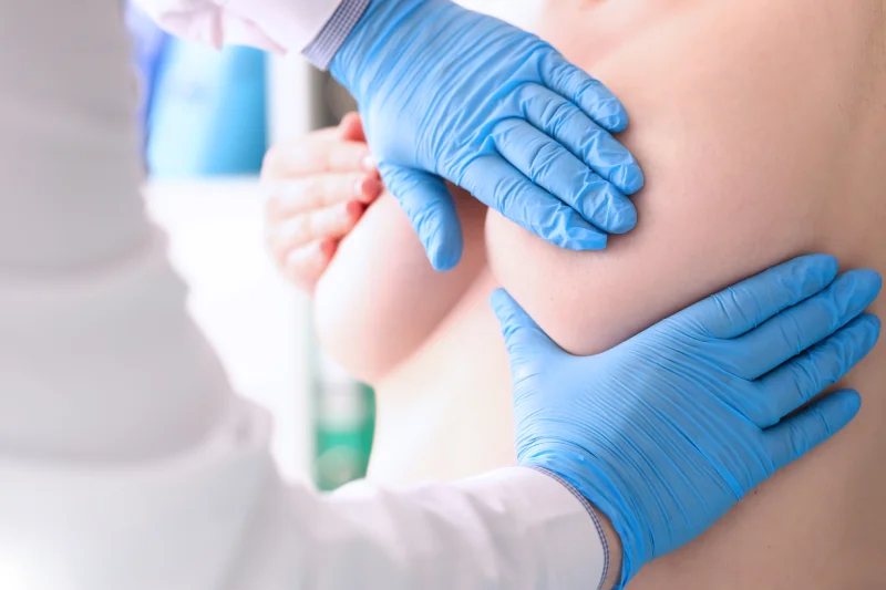 plastic-surgeon-checks-with-his-hands-silicone